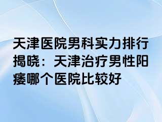 天津医院男科实力排行揭晓：天津治疗男性阳痿哪个医院比较好